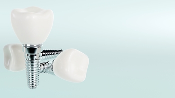 implant dentist whole expenses melbourne